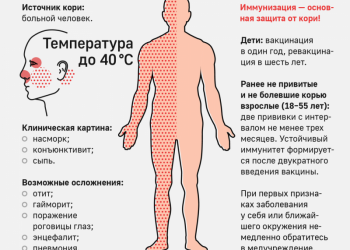 В Самаре вспышка кори. Ульяновск готовится