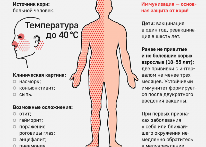 В Самаре вспышка кори. Ульяновск готовится