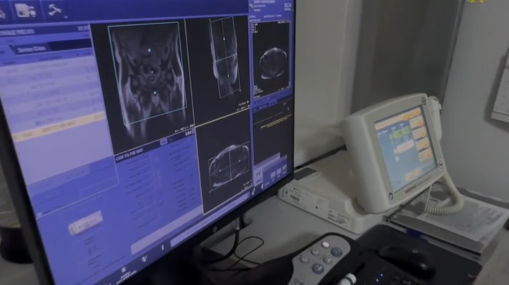 В Ульяновской области стали чаще диагностировать рак на ранних стадиях