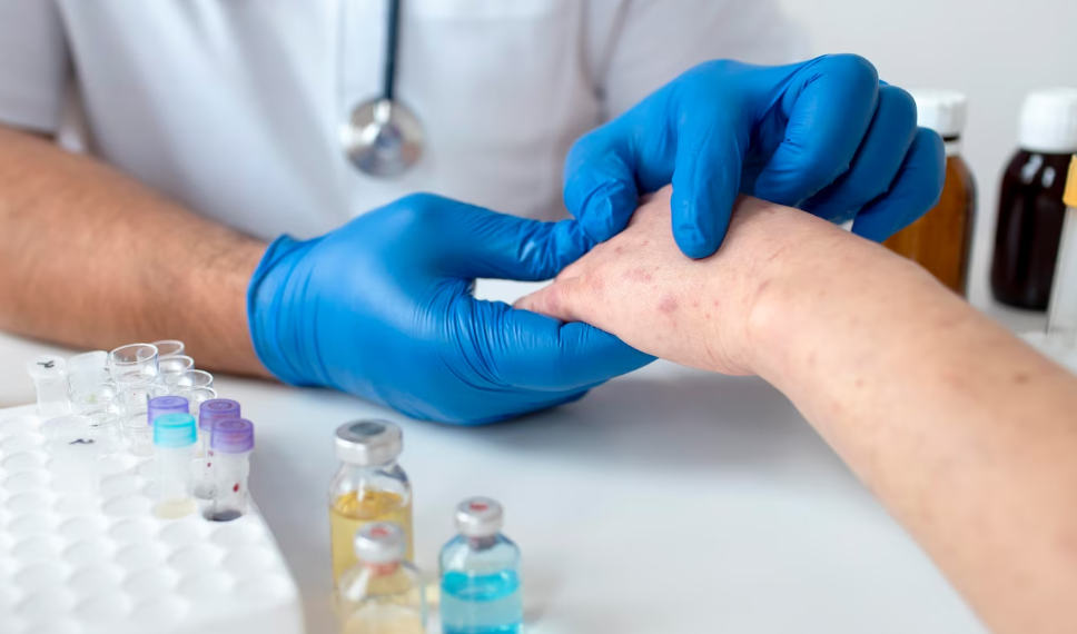 Соцсети пишут о вспышке кори в Мелекесском районе Ульяновской области