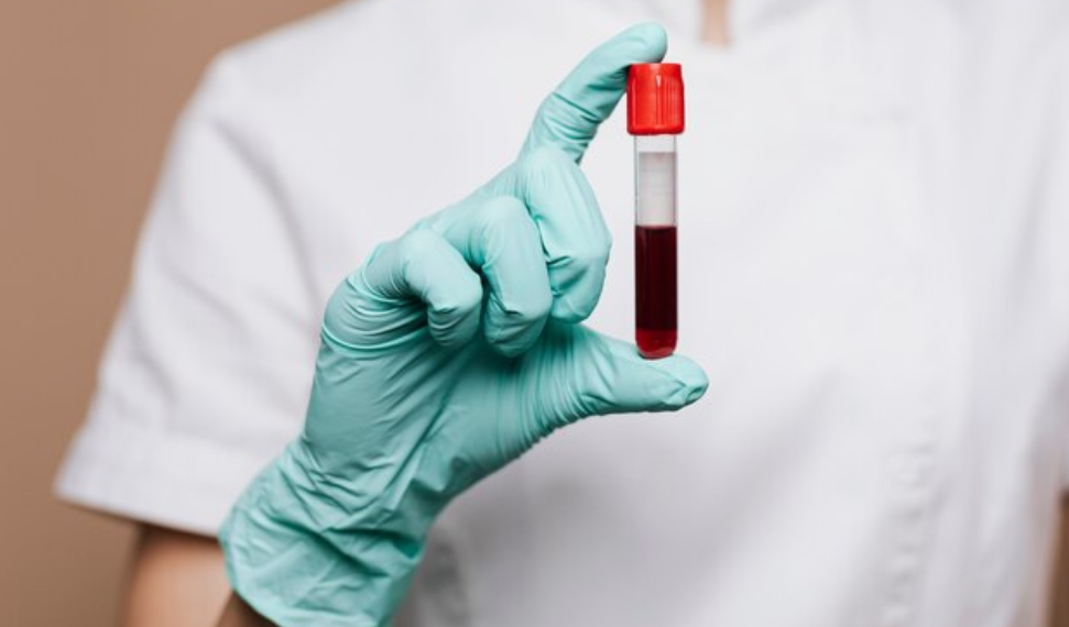 Ульяновску срочно требуются доноры крови второй группы