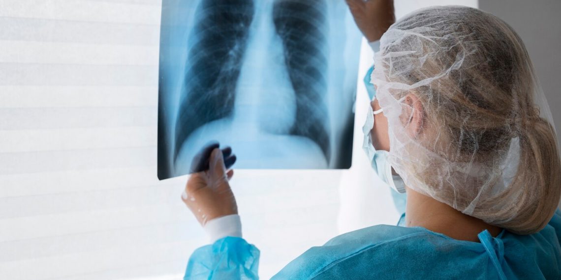 Ульяновцам предлагают подарки за прохождение флюорографии