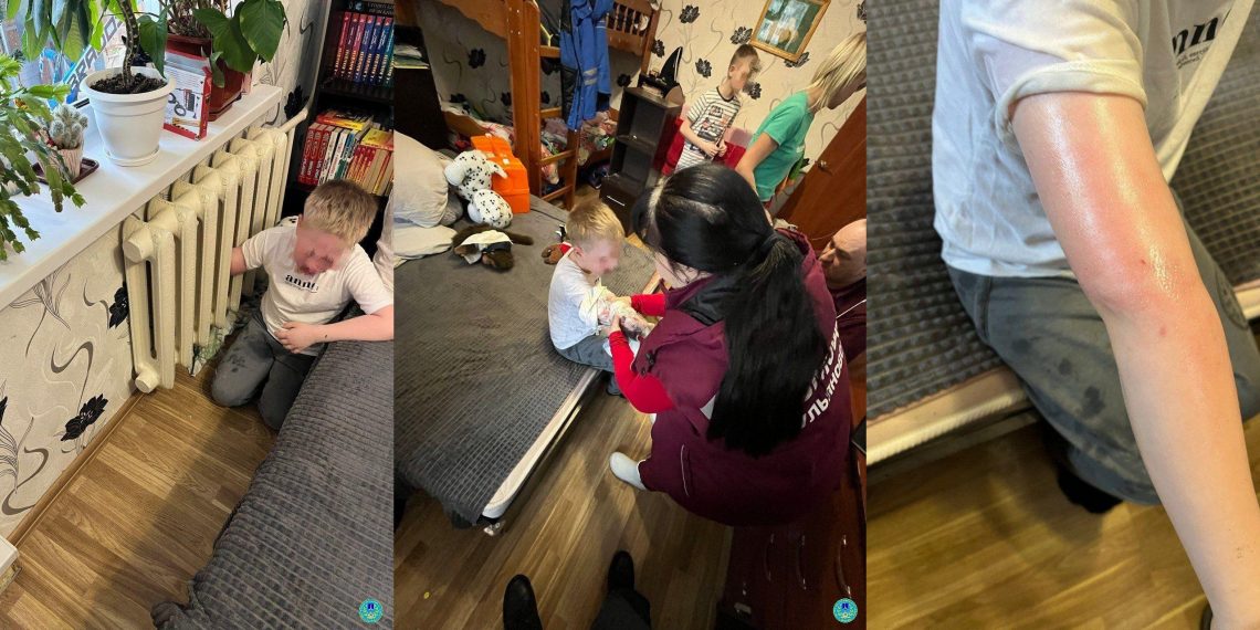 10-летний житель Ульяновска застрял рукой в секции батареи центрального отопления