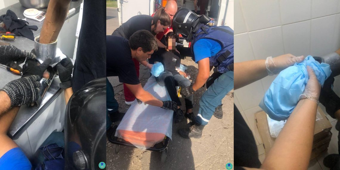 Сотруднику ульяновского кафе затянуло руку в шнек мясорубки