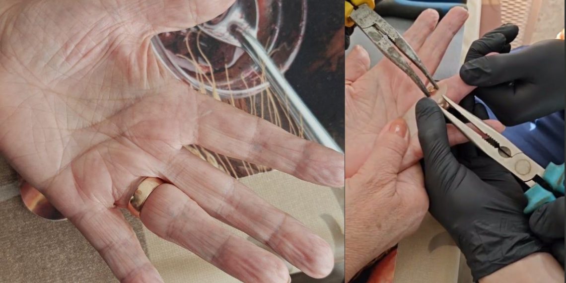 Сотрудники гражданской защиты Ульяновска провели операцию по спасению пальца