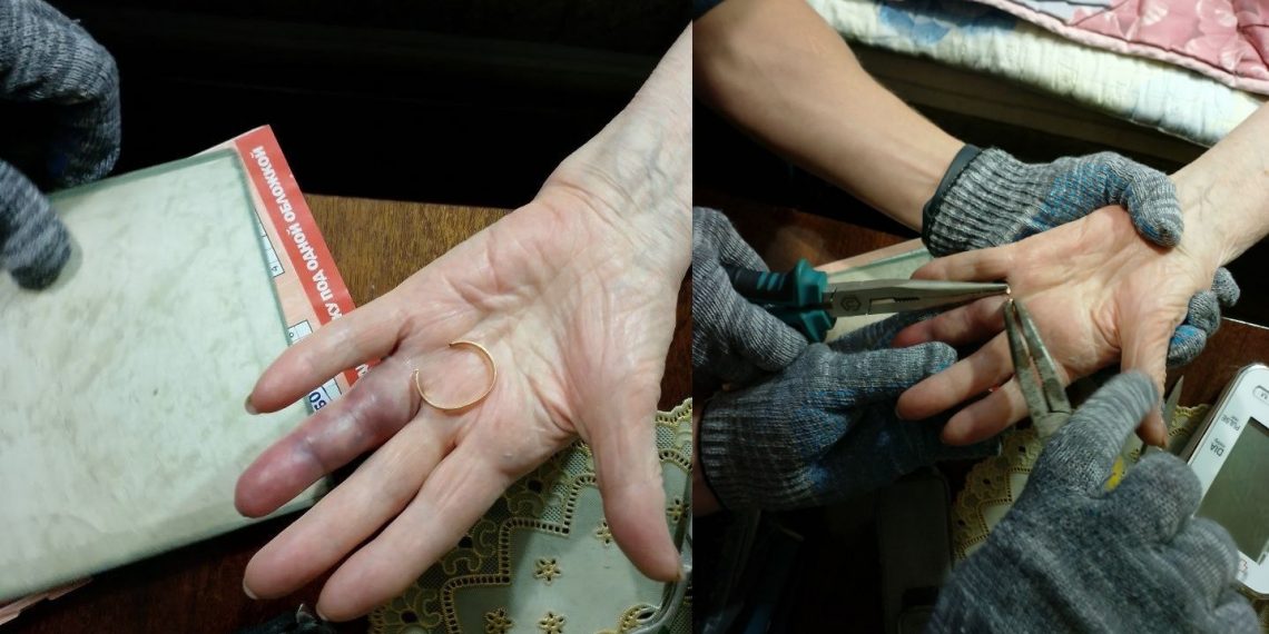 Ульяновские спасатели помогли женщине снять кольцо с распухшего пальца