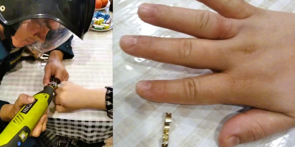 Ульяновские спасатели сняли кольцо с распухшего пальца женщины