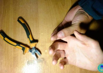 Молодой ульяновец едва не лишился пальца на руке