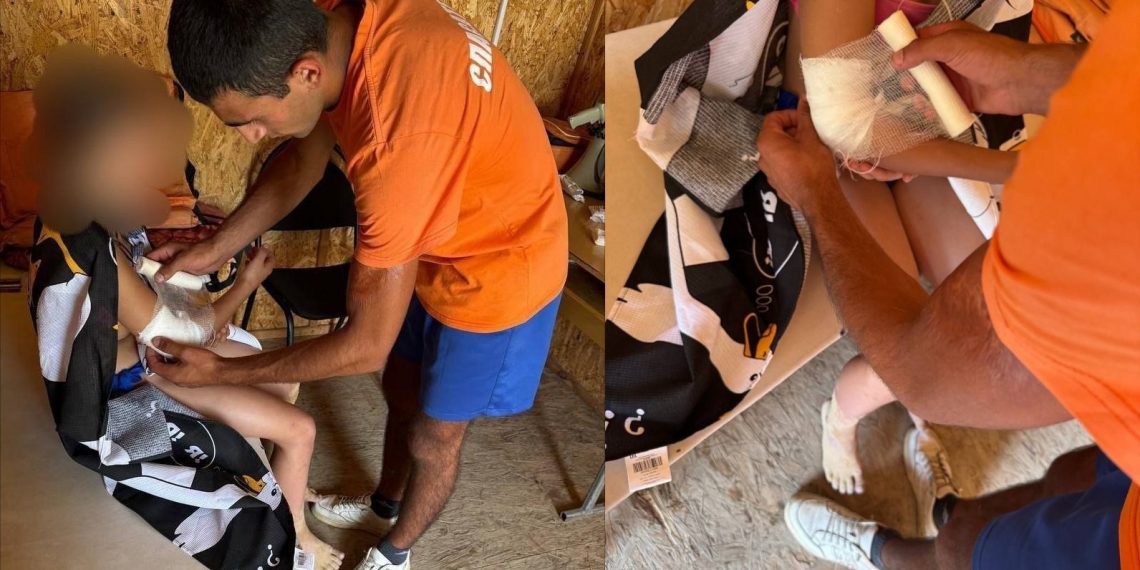 Опасный арбуз: ребёнок поранился на отдыхе в Ульяновске