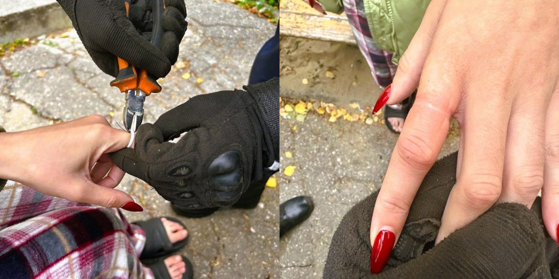 Ульяновские спасатели провели операцию по спасению пальца от кольца