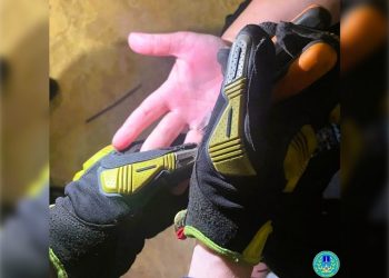 Ульяновские спасатели справились с кольцом на распухшем пальце