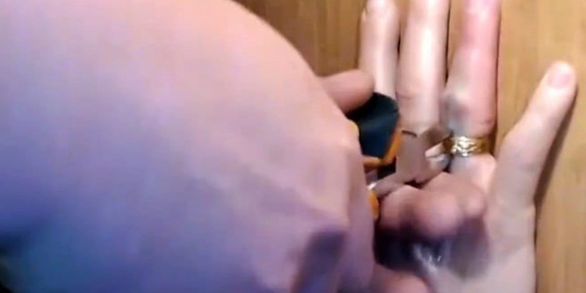 Спасатели провели операцию по спасению пальца жительницы Ульяновска