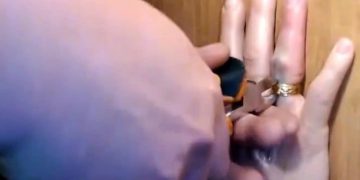 Спасатели провели операцию по спасению пальца жительницы Ульяновска