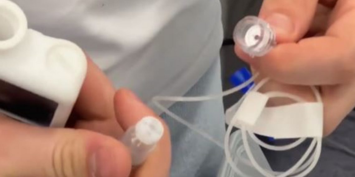 В Ульяновске создали «умную» помпу для диабетиков, которая заменит импорт