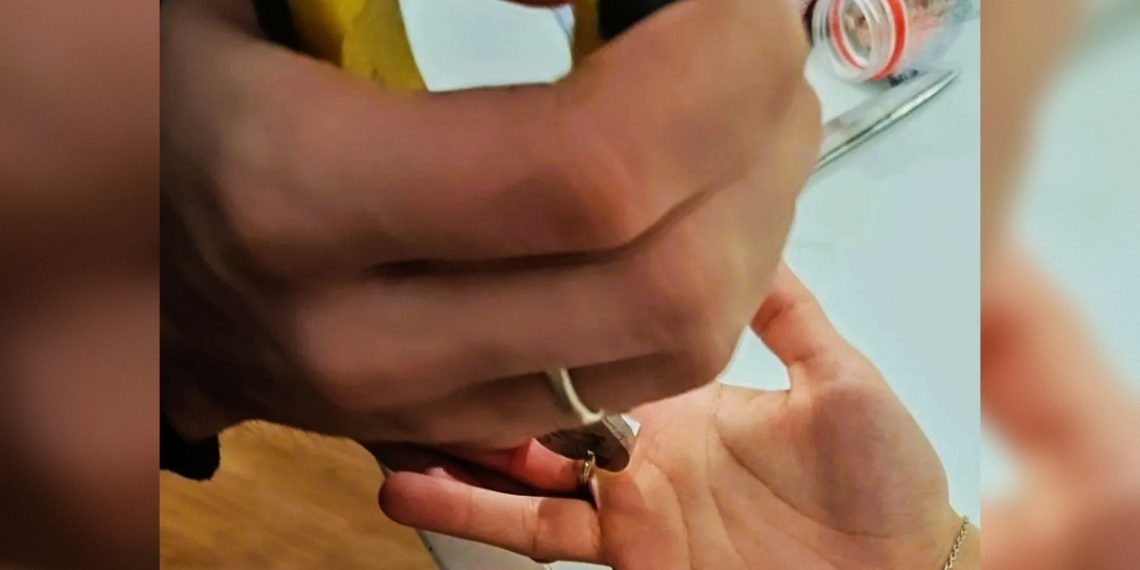 Спасатели в Ульяновске сняли кольцо с помощью специальных инструментов