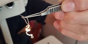 20 сантиметров ужаса: живой червь почти год прожил в глазу ульяновца