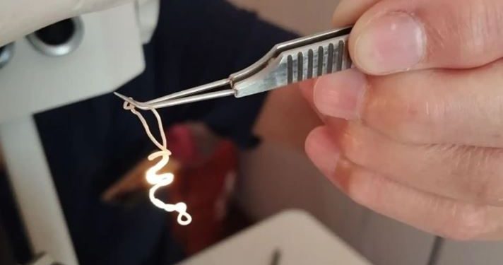 20 сантиметров ужаса: живой червь почти год прожил в глазу ульяновца