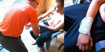 На пляже в Борьбе ульяновские спасатели помогли травмированному парню